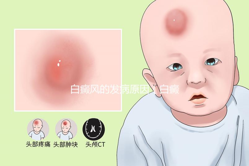 白癜風(fēng)的發(fā)病原因（白癜風(fēng)有自愈的嗎）