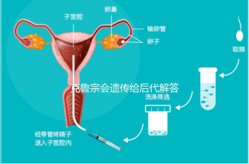 克魯宗會(huì)遺傳給后代解答嗎？他生來就有一篇清晰的文章嗎？