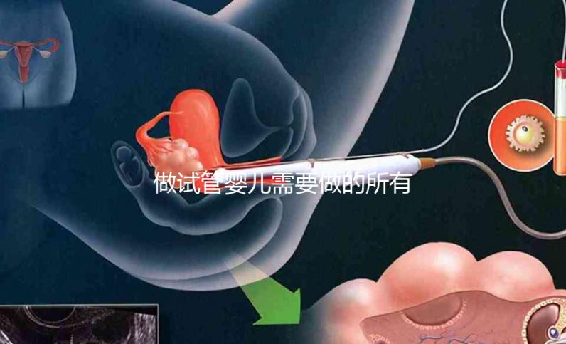 做試管嬰兒需要做的所有檢查（做試管嬰兒需要做的所有檢查項目）