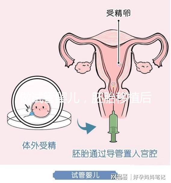 做試管嬰兒，胚胎移植后需要住院嗎？