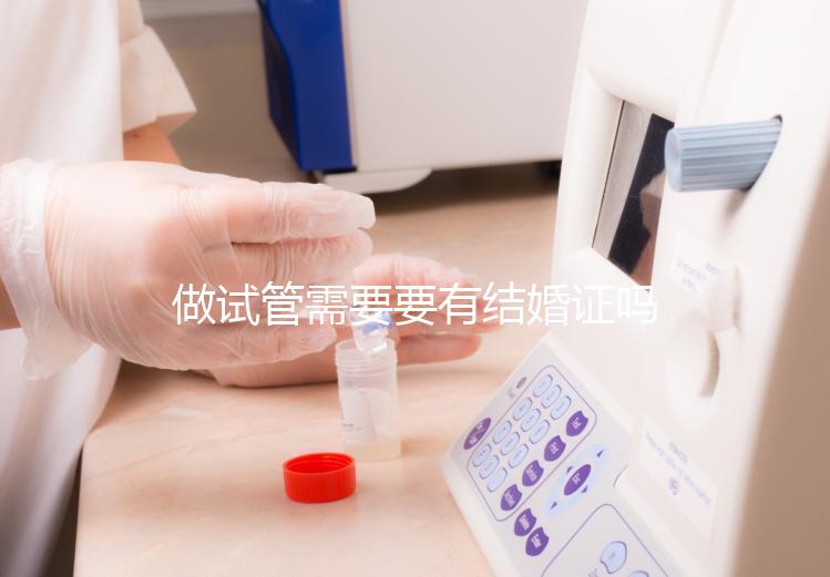 做試管需要要有結婚證嗎？做試管需要結婚證
