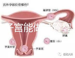 雙角子宮能做試管嬰兒嗎？可以，但這2大條件缺一不可