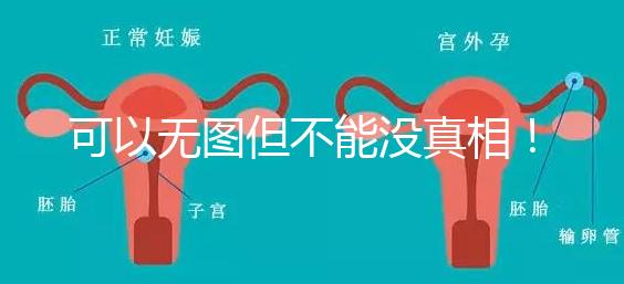 可以無(wú)圖但不能沒(méi)真相！段濤大夫帶你了解B超檢查報(bào)告單