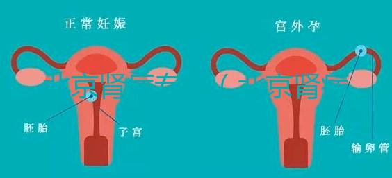 北京腎病專家（北京腎病專家前十名）