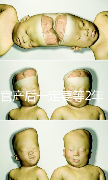 剖宮產后一定要等2年，才能試管嬰兒懷孕嗎？