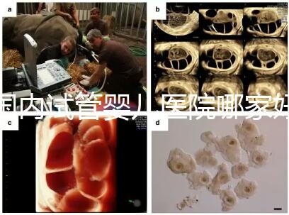 國內試管嬰兒醫院哪家好?慈銘博鰲深受患者信賴