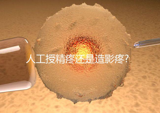 人工授精疼還是造影疼?被瞎對比，二者疼痛不是一個等級