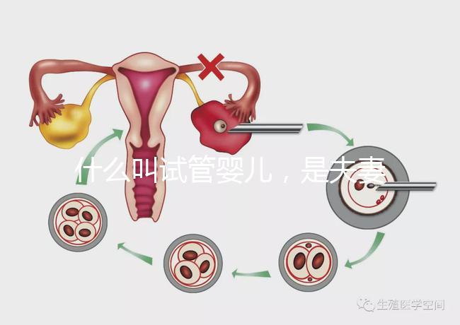 什么叫試管嬰兒，是夫妻親生的嗎？