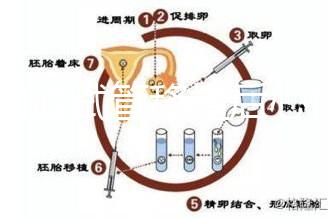 不知道試管移植后心悸影不影響床速發(fā)生了什么事