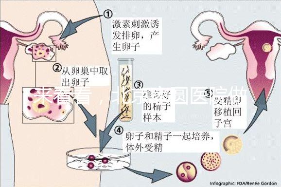 來看看,北京家圓醫(yī)院做三代試管費(fèi)用總共多少?