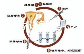 浙江27家試管嬰兒醫(yī)院成功率排名公開，邵逸夫醫(yī)院位居前十