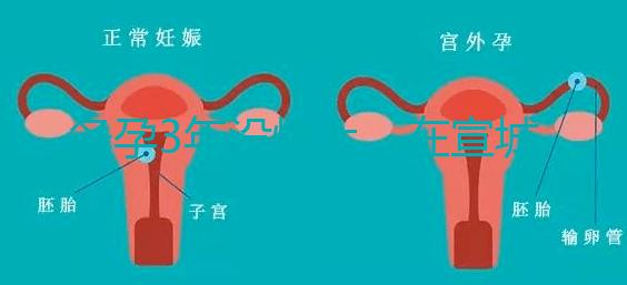 備孕3年沒懷上，在宣城可以做試管嬰兒嗎？