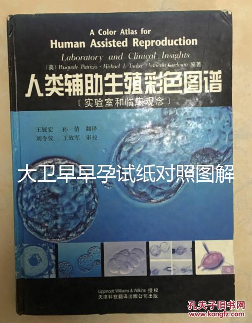 大衛(wèi)早早孕試紙對照圖解，教你怎么看結(jié)果是不是陽性