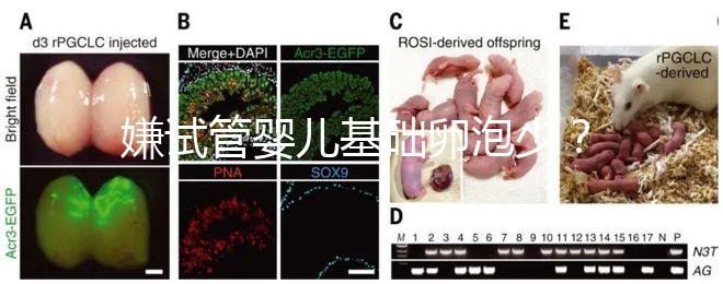 嫌試管嬰兒基礎卵泡少？并非只能食療，這份增多錦囊請收下