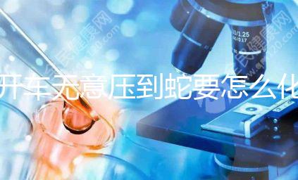 開車無意壓到蛇要怎么化解進來瞧，要不要報警一目了然