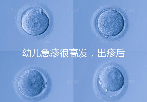 幼兒急疹很高發(fā)，出疹后的護(hù)理方法及注意事項(xiàng)提前知曉！