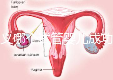 遵義哪個試管嬰兒成功率高?貴州生殖中心醫(yī)院2024年排名參考