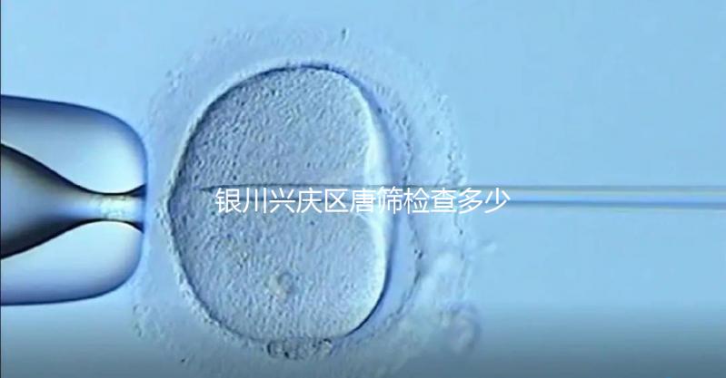 銀川興慶區(qū)唐篩檢查多少錢取決于情況，2024年國家免費(fèi)限額