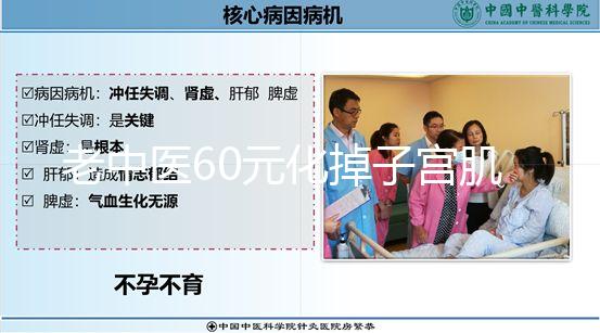 老中醫60元化掉子宮肌瘤偏方一覽，三棱效果怎樣用了就造