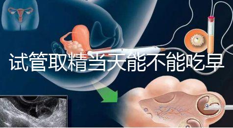 試管取精當天能不能吃早餐喝水的答案來咯咯，好不好一看就知道了？