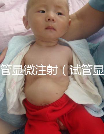 試管顯微注射（試管顯微注射什么藥）