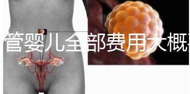 試管嬰兒全部費(fèi)用大概要多少錢？