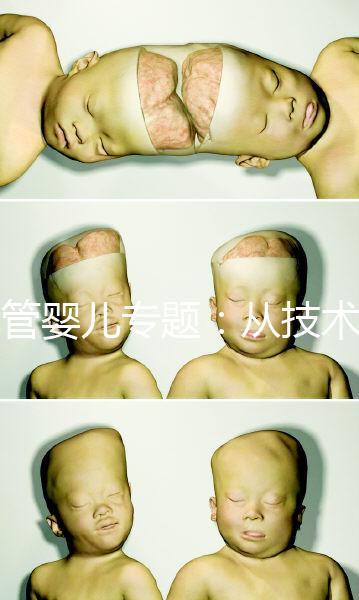 試管嬰兒專題：從技術(shù)原理解讀到成功案例分享