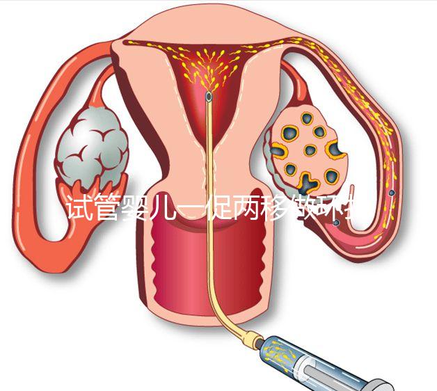 試管嬰兒一促兩移做環扎好看嗎？小心這些影響