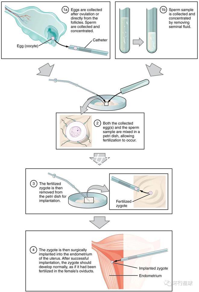 貴陽未婚子女戶口如何向婦女介紹，附2024年結(jié)算流程
