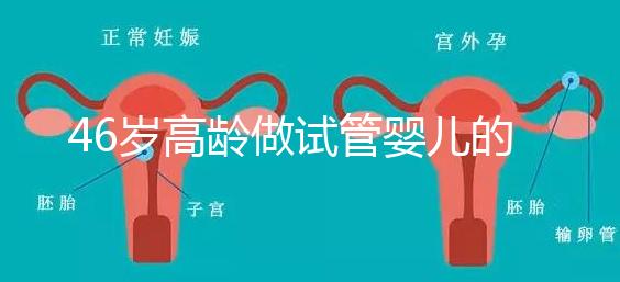 46歲高齡做試管嬰兒的成功幾率有多大？聽聽大家怎么說